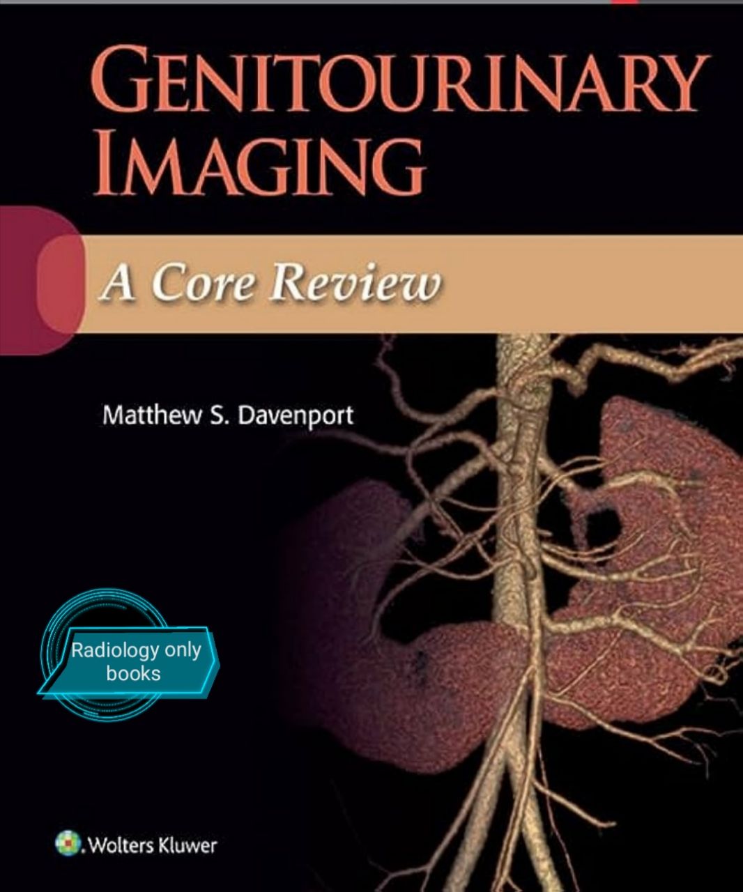 Genitourinary Imaging: A Core Review